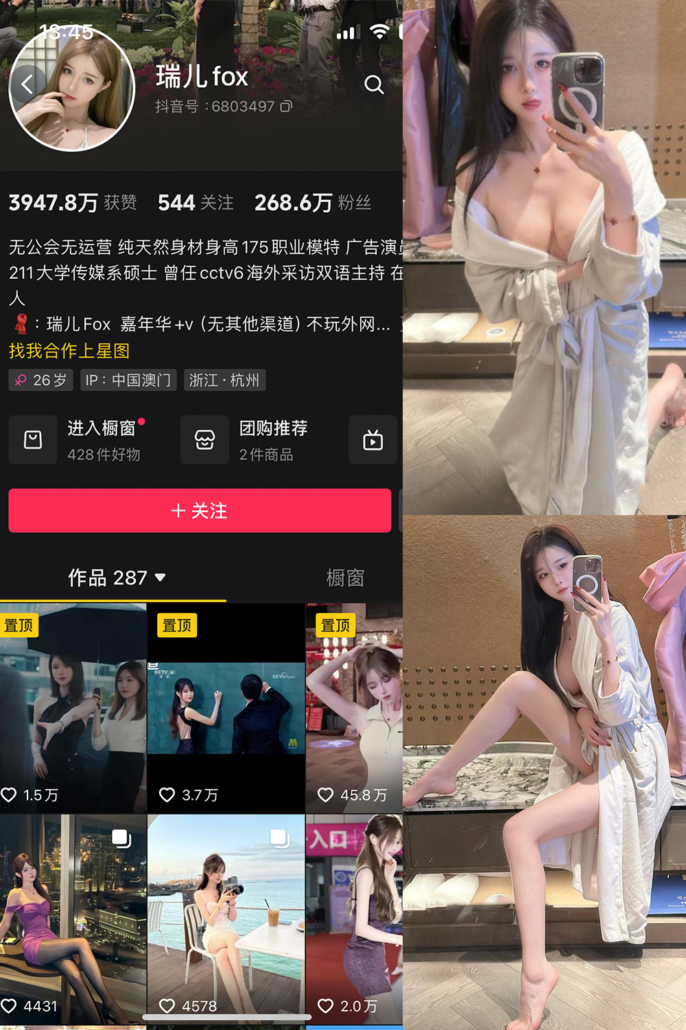 抖音 瑞儿fox 微密圈 NO.007期 【25P】