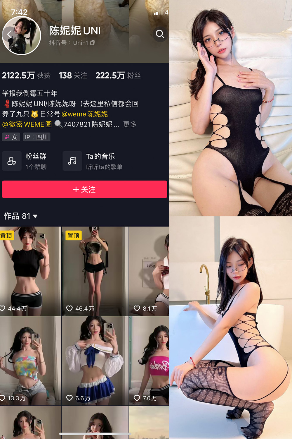 抖音 陈妮腻UNI 微密圈 NO.036期 【38P】