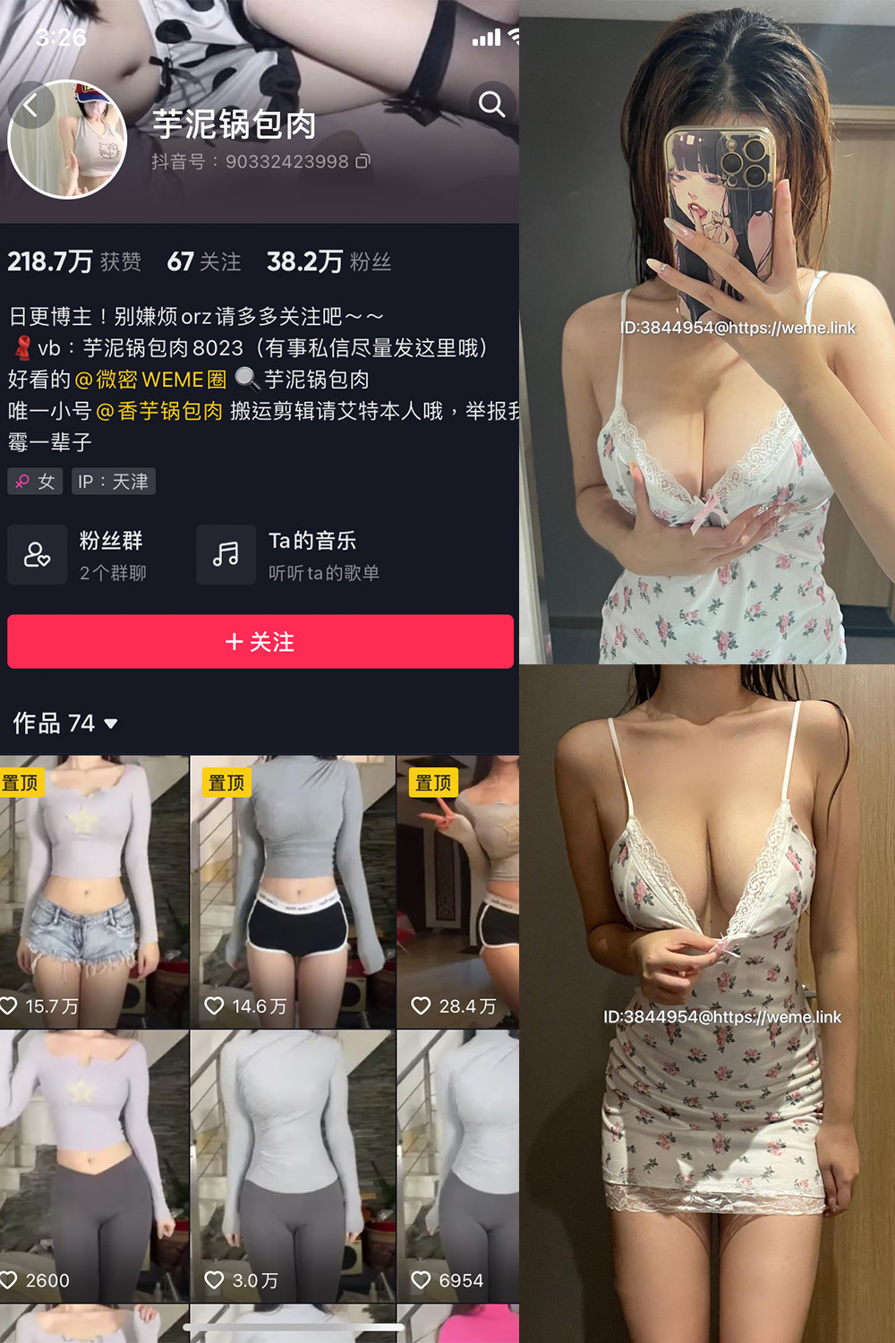 抖音 芋泥锅包肉 微密圈 NO.013期 【35P2V】