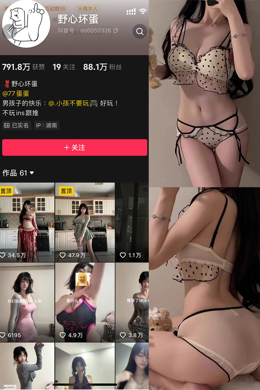 抖音 野心坏蛋 微密圈 NO.007期 【13P】